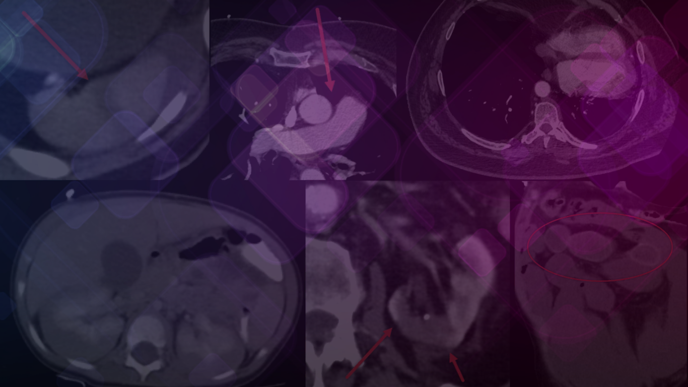 Radiology Board Review Banner